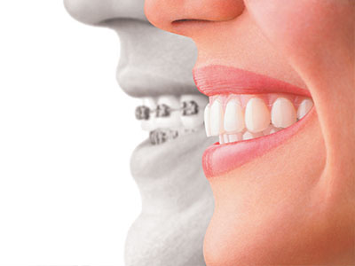 Glendale Family Dental | Implant Dentistry, Oral Exams and Dental Fillings