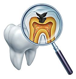 Glendale Family Dental | Digital Radiography, Oral Cancer Screening and Emergency Treatment