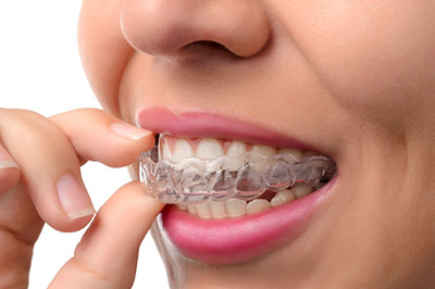 Glendale Family Dental | Ceramic Crowns, Dentures and Extractions