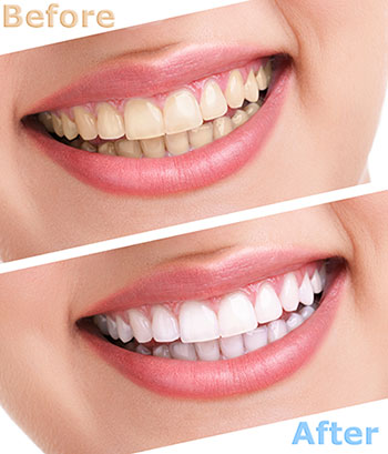 Glendale Family Dental | Cosmetic Dentistry, Emergency Treatment and Implant Restorations