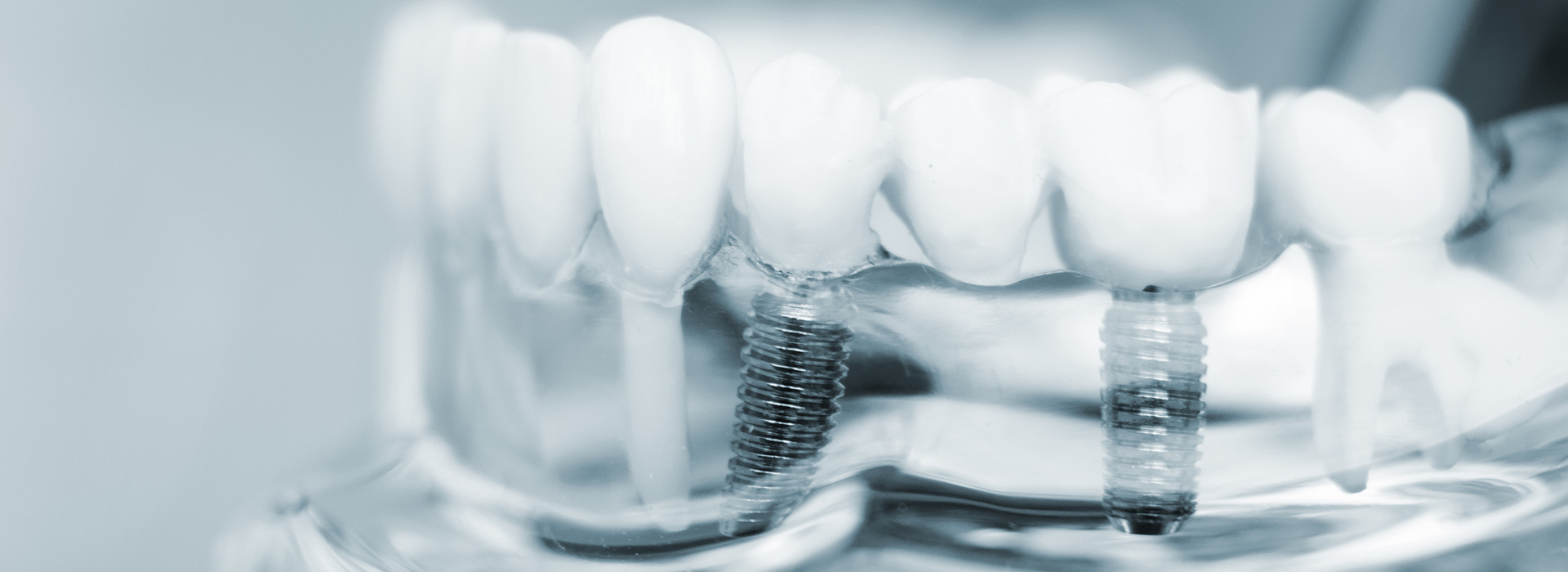 Glendale Family Dental | Dentures, Oral Cancer Screening and Emergency Treatment