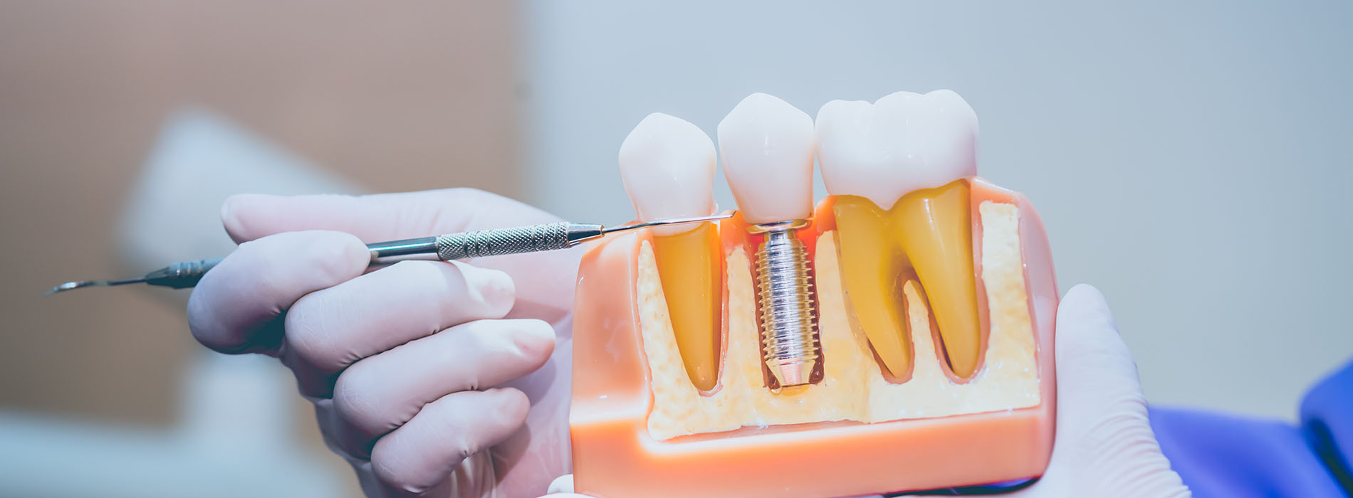 Glendale Family Dental | Oral Exams, Digital Radiography and Implant Dentistry