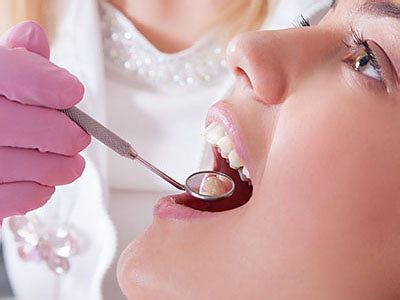 Glendale Family Dental | Implant Restorations, Oral Exams and Dental Cleanings